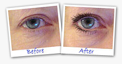 eye secrets before and after